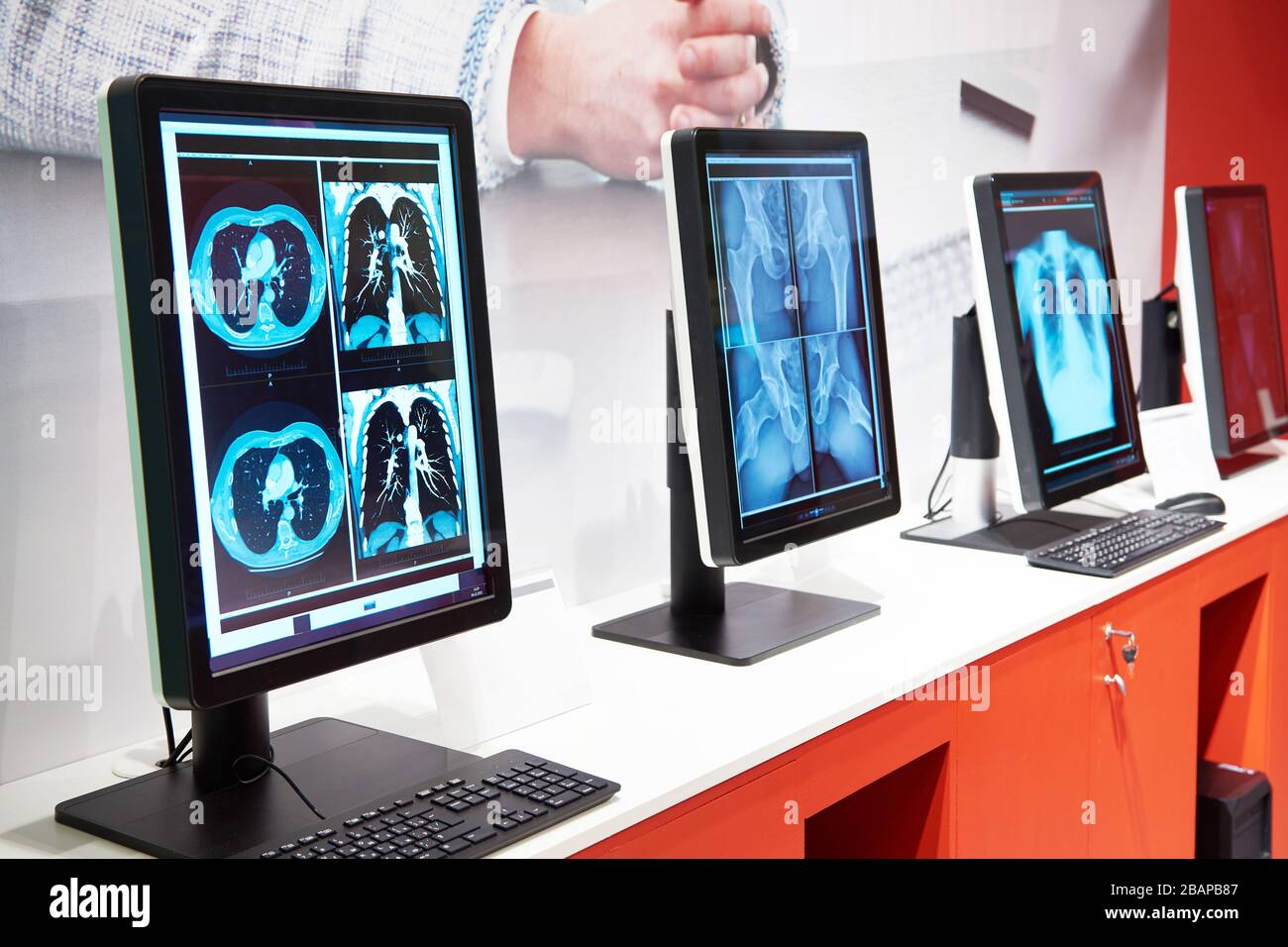 Computer mit Monitoren für Medizin in der Ausstellung Stockfoto