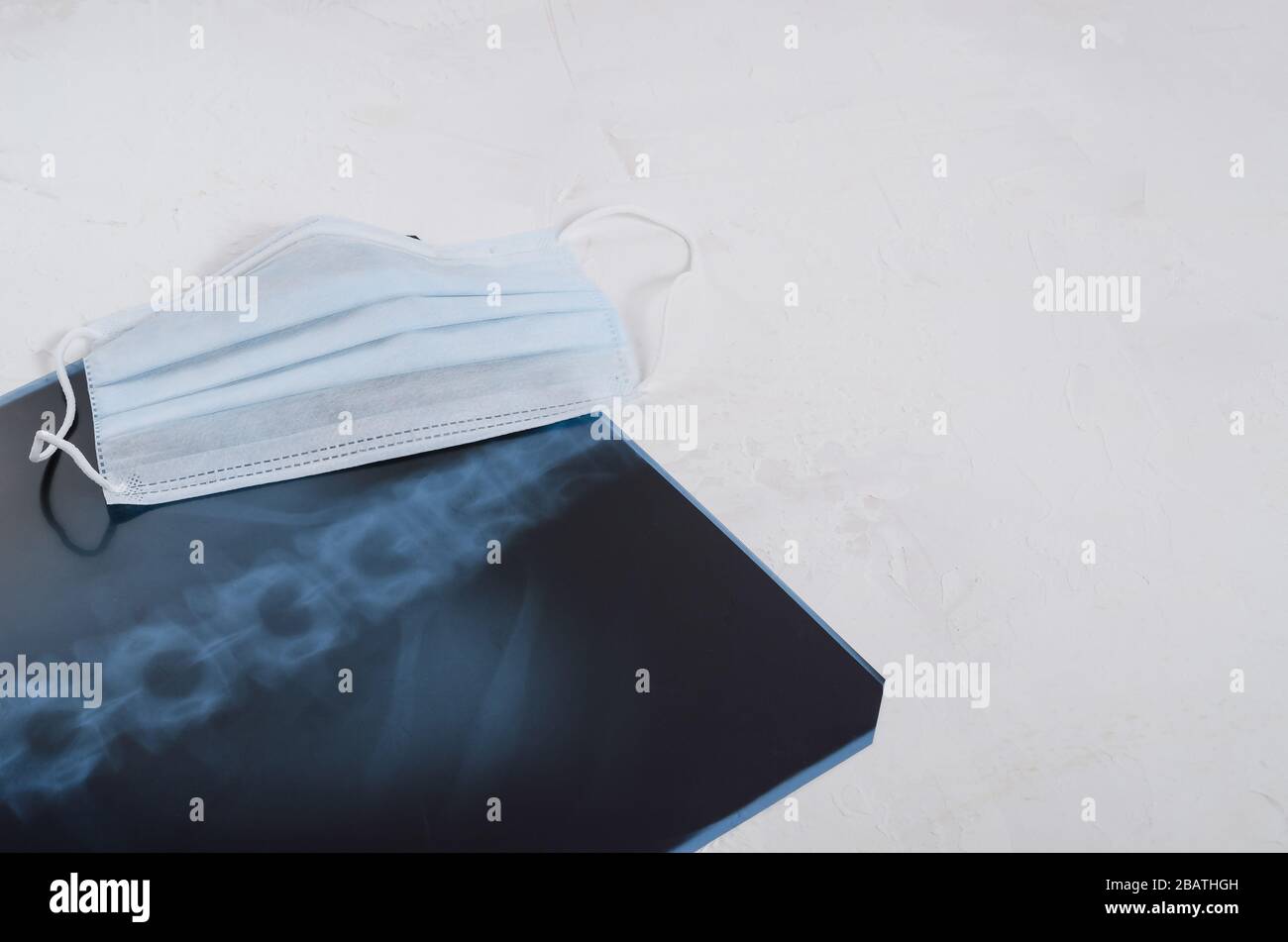 Röntgenaufnahme der Lunge, chirurgische medizinische Maske auf weißem Hintergrund, Pneumonie und Bronchitis Konzept. Virusinfektion. Stockfoto