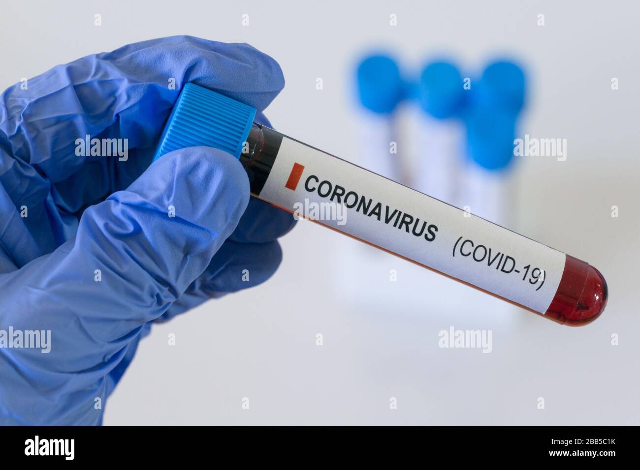 Blutprobe Coronavirus Covid 19, Virus-Bluttest SARS COV 2 Stockfoto