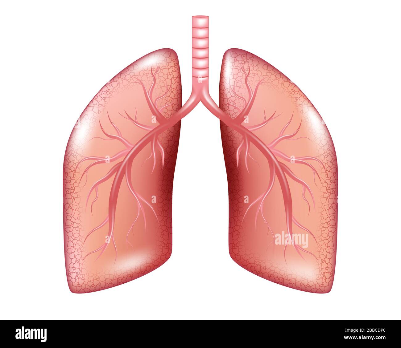 Human Lung Cancer Diagramm isoliert. Grafiken zu respiratorischem Krankheitsbild. Realistische Lungenanatomie. Vektorgrafiken Stock Vektor