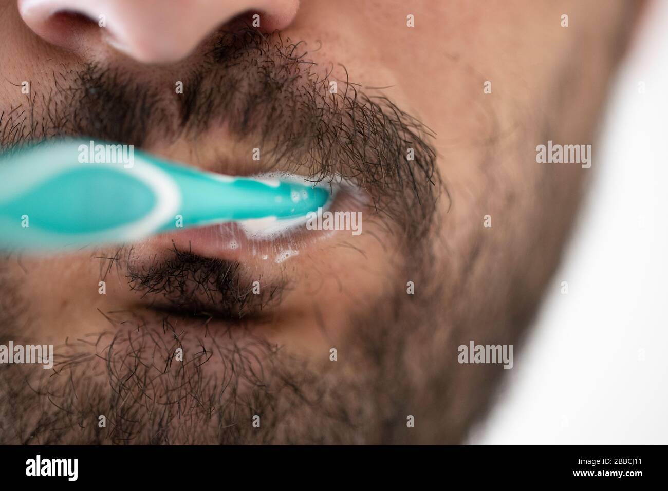 Verfallene Zähne schließen sich. Am Zahn befinden sich braune Flecken Stockfotografie Alamy