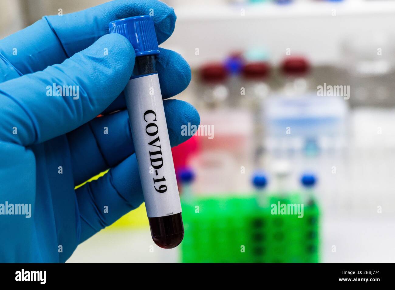 Prüfung auf COVID-19. Eine Blutröhre zum Nachweis von Coronavirus SARS-COV-2. Stockfoto