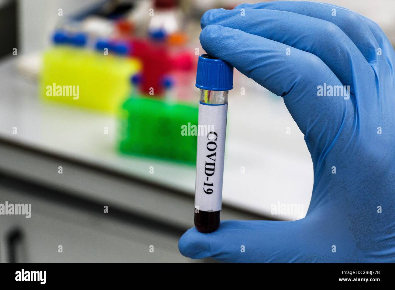 Prüfung auf COVID-19. Eine Blutröhre zum Nachweis von Coronavirus SARS-COV-2. Stockfoto
