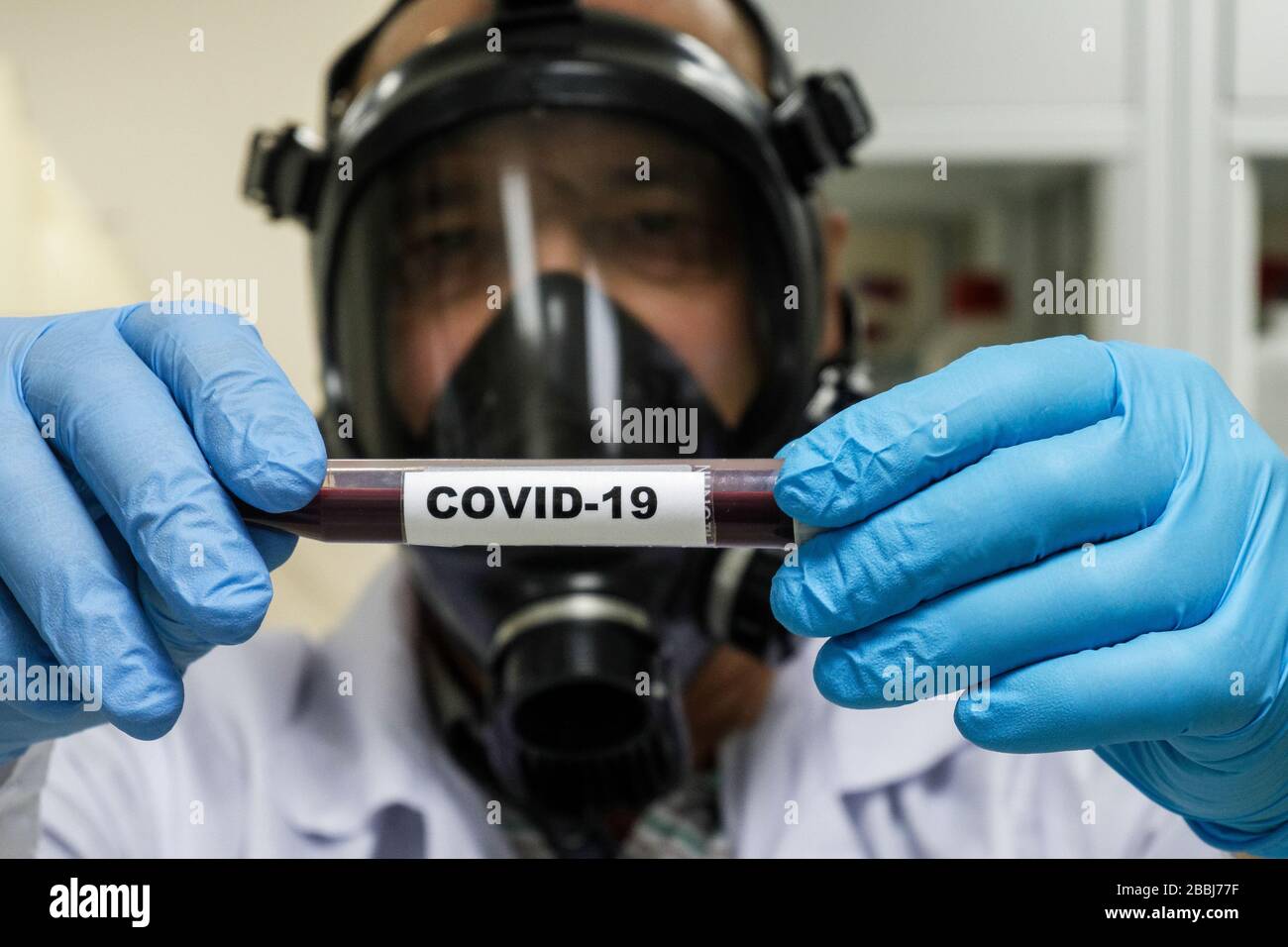 Prüfung auf COVID-19. Eine Blutröhre zum Nachweis von Coronavirus SARS-COV-2. Stockfoto