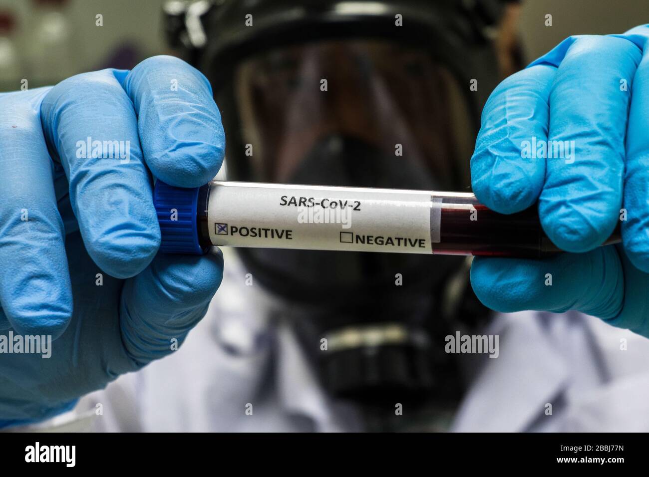 Prüfung auf COVID-19. Eine Blutröhre zum Nachweis von Coronavirus SARS-COV-2. Stockfoto