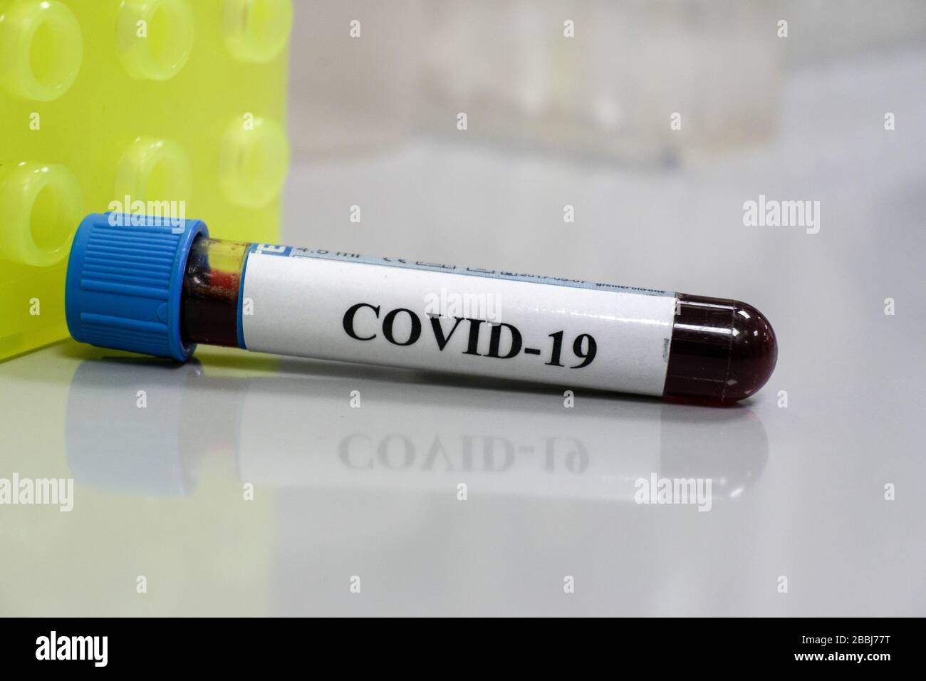 Prüfung auf COVID-19. Eine Blutröhre zum Nachweis von Coronavirus SARS-COV-2. Stockfoto