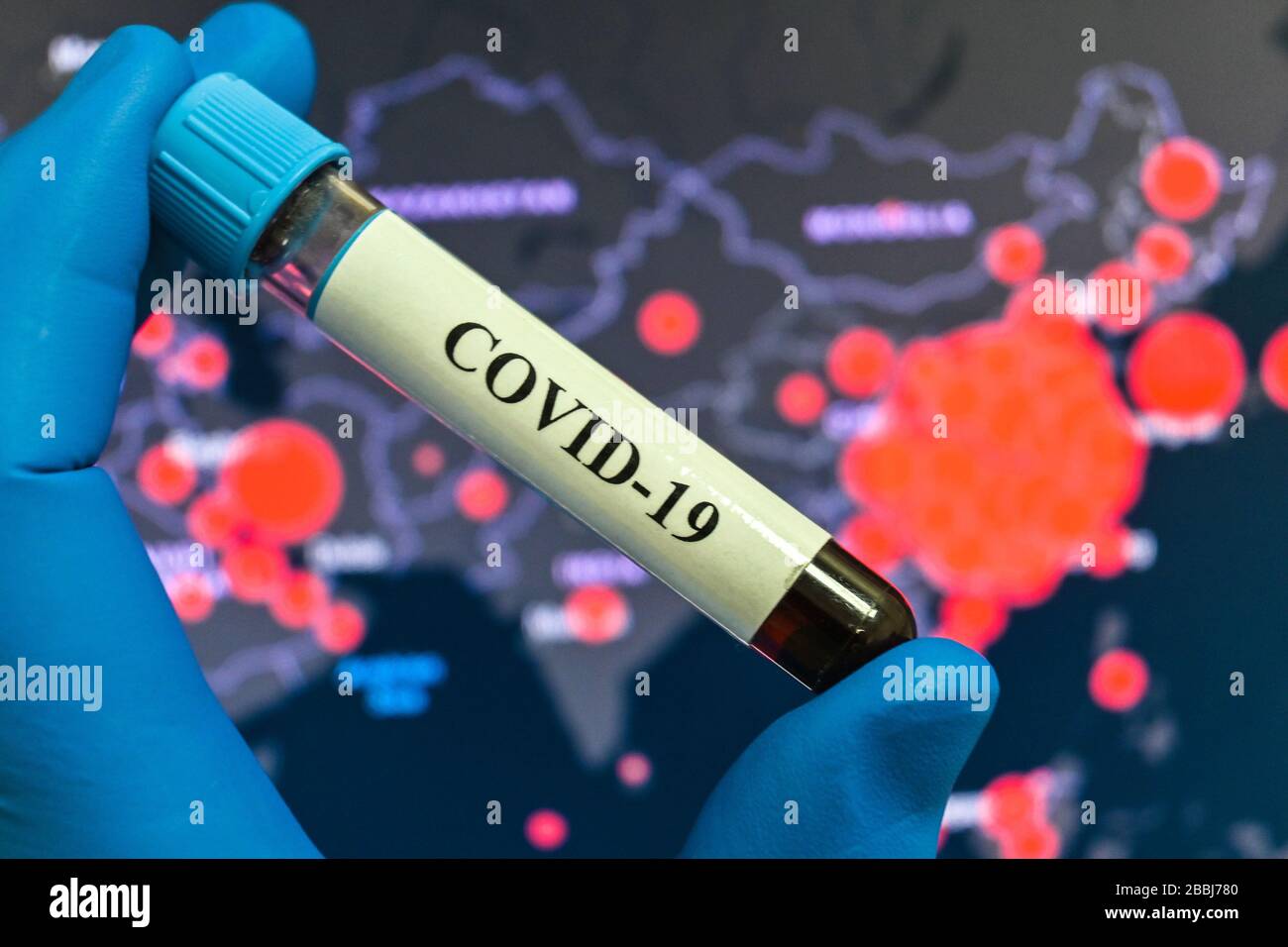Prüfung auf COVID-19. Eine Blutröhre zum Nachweis von Coronavirus SARS-COV-2. Stockfoto