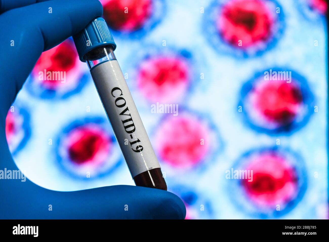Prüfung auf COVID-19. Eine Blutröhre zum Nachweis von Coronavirus SARS-COV-2. Stockfoto