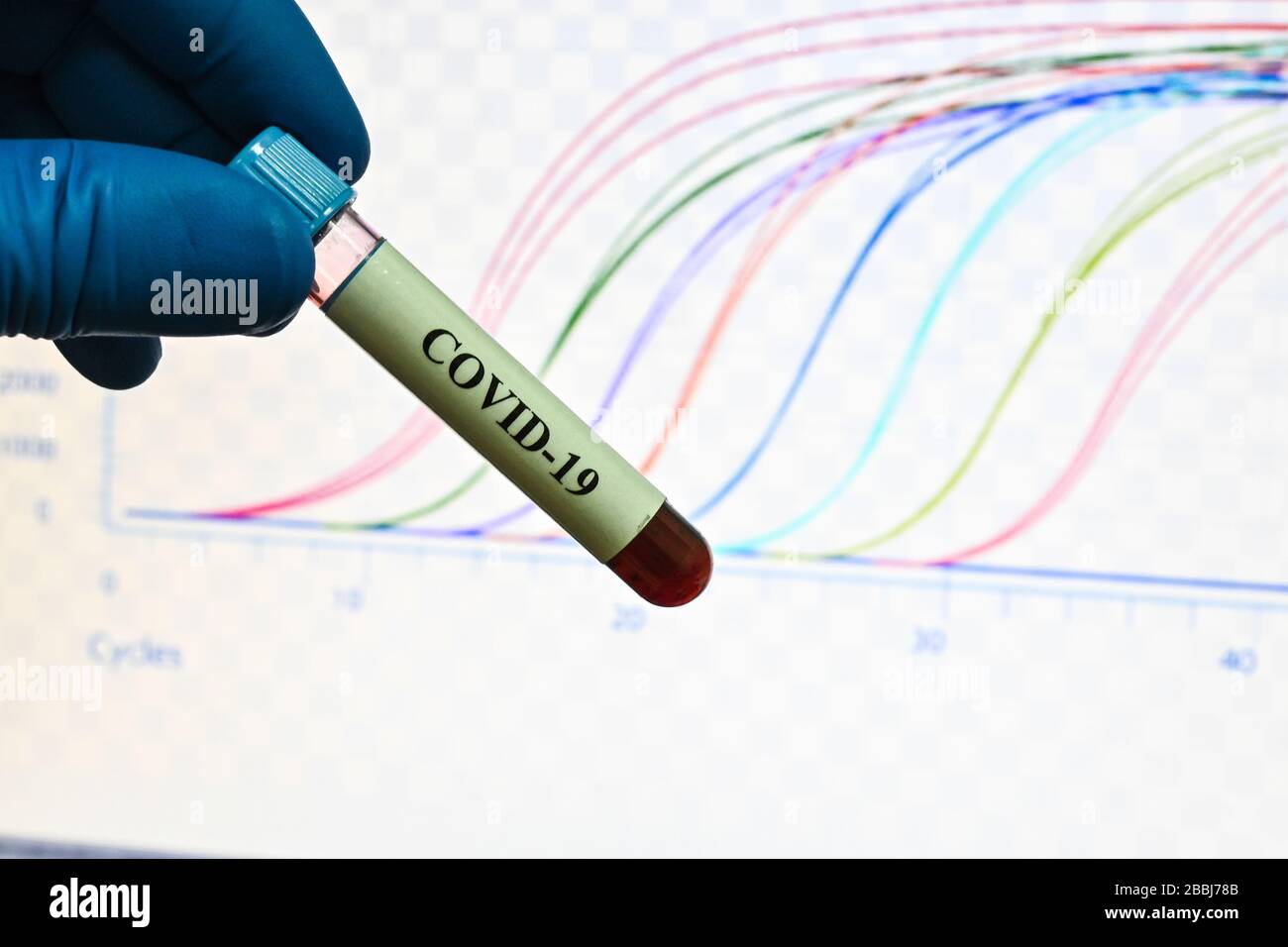 PCR-Nachweis von Coronavirus SARS-COV-2. Blutprobe für die Forschung zu COVID-19. Stockfoto