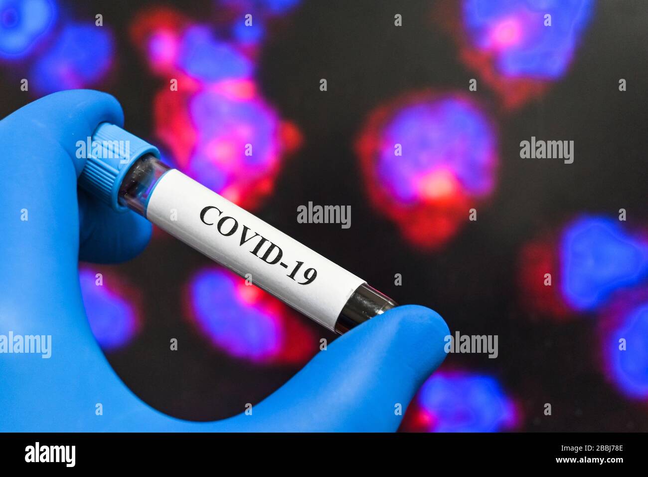 Prüfung auf COVID-19. Eine Blutröhre zum Nachweis von Coronavirus SARS-COV-2. Stockfoto