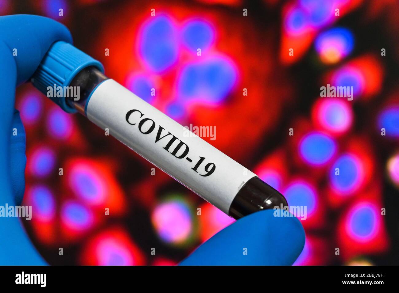 Prüfung auf COVID-19. Eine Blutröhre zum Nachweis von Coronavirus SARS-COV-2. Stockfoto