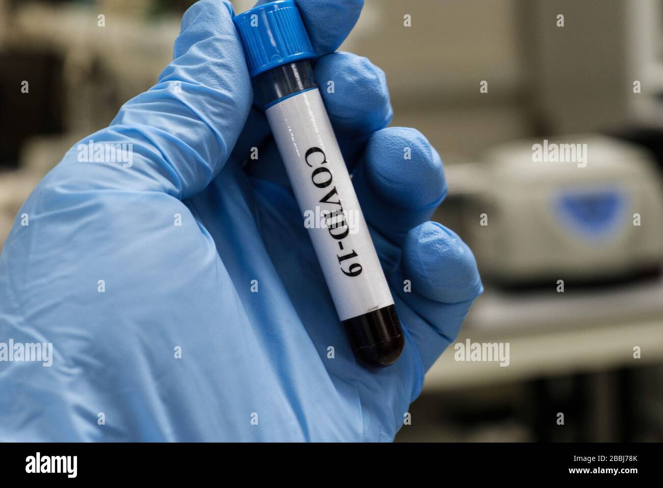 Prüfung auf COVID-19. Eine Blutröhre zum Nachweis von Coronavirus SARS-COV-2. Stockfoto