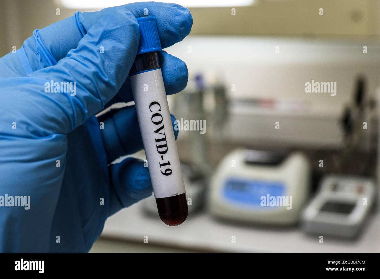 Prüfung auf COVID-19. Eine Blutröhre zum Nachweis von Coronavirus SARS-COV-2. Stockfoto