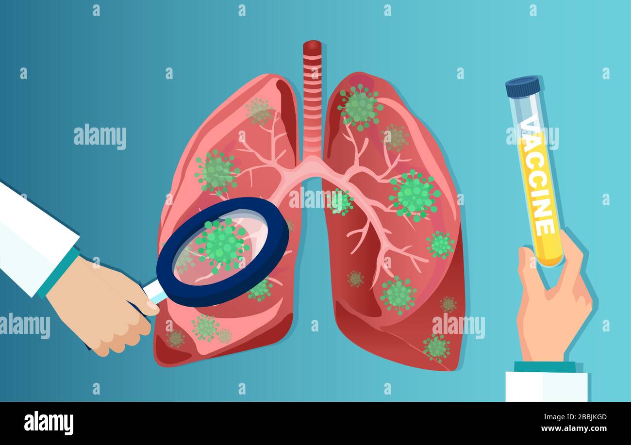 Vektor eines Arztes mit Lupe, der Coronavirus analysiert, betraf die Lunge und hielt einen Schlauch mit Impfstoff Stock Vektor