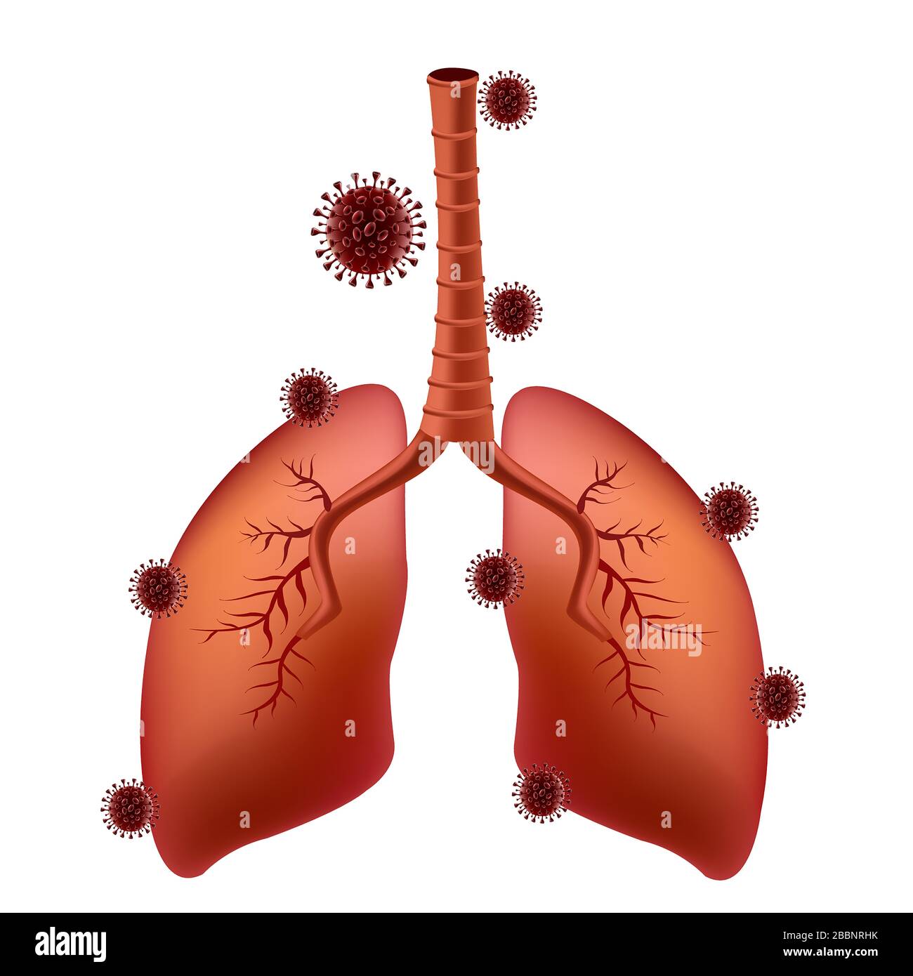corona-virus Kovid-19 haftet an der Lunge des Lungenkatienten Stockfoto