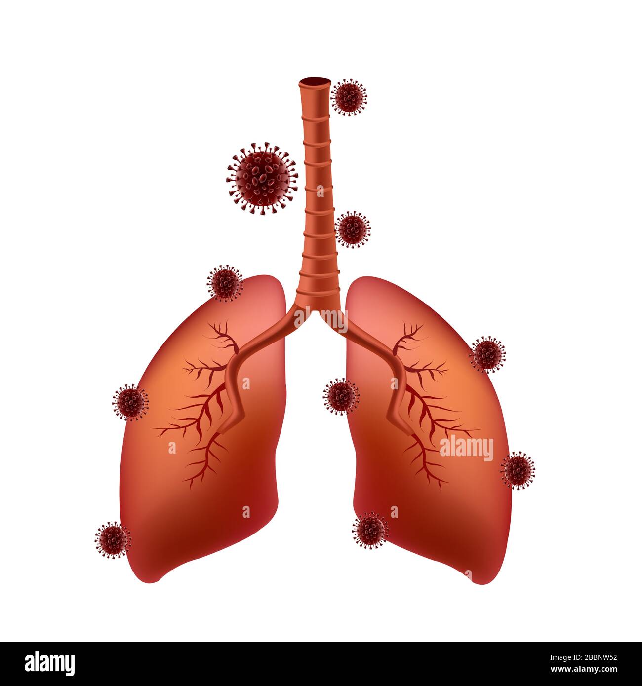 corona-virus Kovid-19 haftet an der Lunge des Lungenkatienten Stock Vektor
