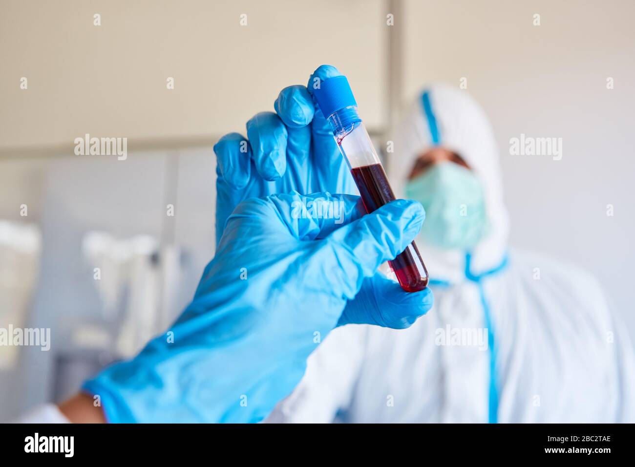 Blutprobe des Covid-19-Patienten für Antikörpertests in der Klinik während der Coronavirus-Epidemie Stockfoto