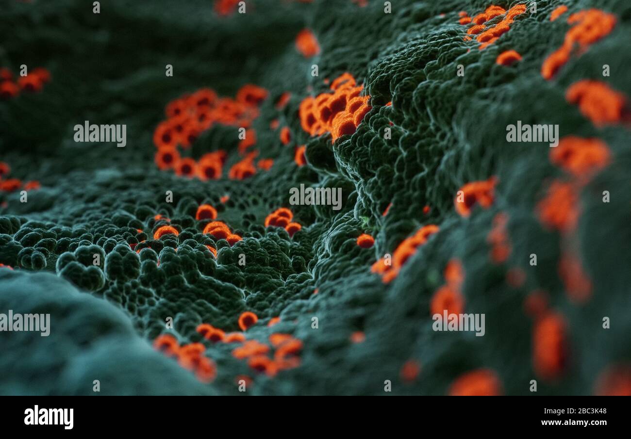 Elektronische Mikroskopie von Coronavirus SARS COVID-19, die menschliche Zellen infiziert, 3D-Illusion auf der Grundlage elektronischer mikroskopischer Fotos Stockfoto