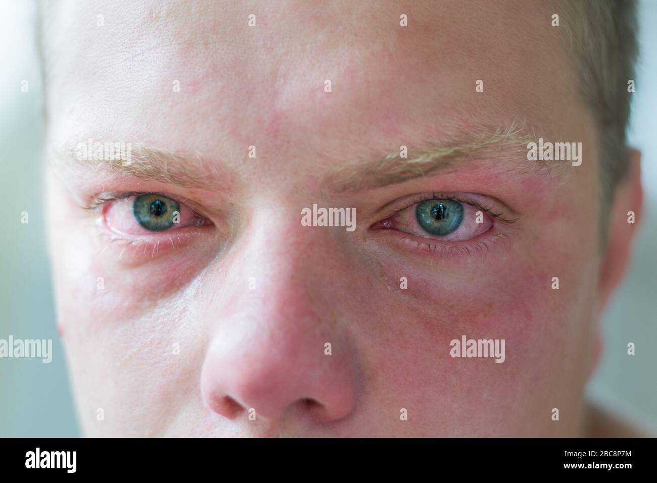 Gesicht des weinenden Mannes mit blauen Augen Stockfoto