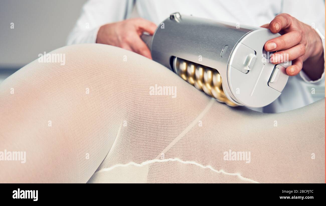 Masseur macht in der Klinik für Kosmetologie eine Anti-Zellulite-Massage Stockfoto