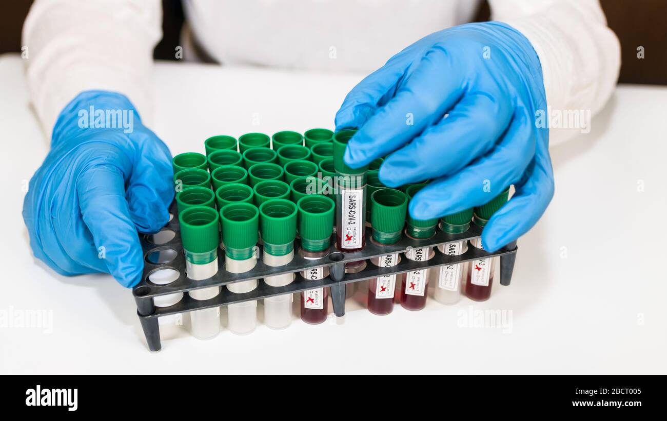 Laborblutprobenröhrchen im Rack. Positive oder negative SARS-COV-2-Ergebnisse. Testzentrum für pandemische Coronavirus-Erkrankungen. COVID-19 Virusinfektion. Stockfoto