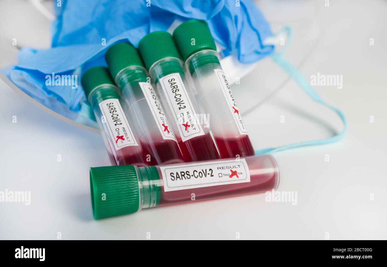 Pandemie COVID-19. Medizinische Probenröhrchen, positives oder negatives Ergebnis des SARS-COV-2-Tests. Ausbruch des Coronavirus. Abstraktes Stillleben im Labor. Prüfzentrum. Stockfoto