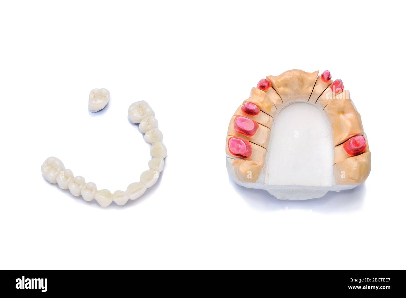 Künstliche Keramik Kronen und Brücken mit einem Gipsmodell der Zähne des Oberkiefers isoliert auf weißem Hintergrund. Konzept der orthopädischen Zahnstr Stockfoto
