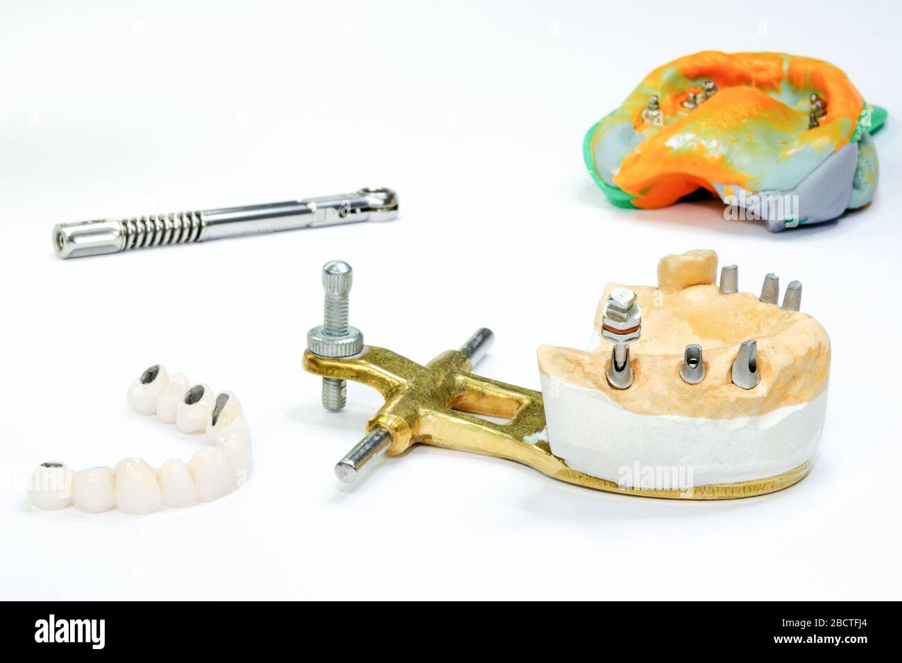 Kiefer Modell mit Zahnimplantaten und keramischen Kronen. Im Hintergrund ist ein zahnärztlicher Eindruck mit Implantat-Tools. Der Prozess der Herstellung Delle Stockfoto