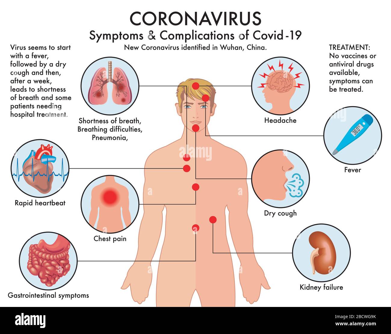 Diagramm der Symptome und Komplikationen von Coronavirus (Covid-19) mit Anmerkungen. Stockfoto