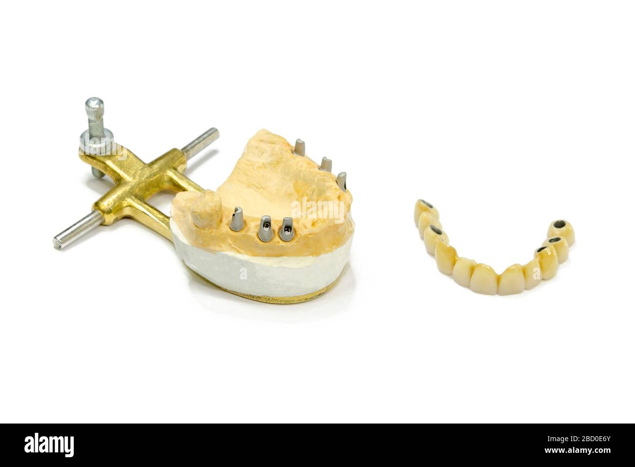 Zahnimplantate. Dentale Keramik Kronen auf Implantaten. Künstliche Zähne auf Abutments. Keramik Kronen auf künstlichen Wurzeln. Isoliert Stockfoto