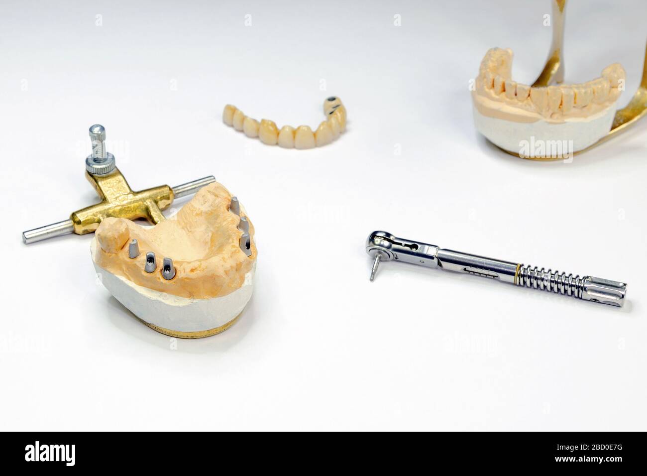 Orthopädische Zahnheilkunde. Herstellung von künstlichen Zähnen. Zahnimplantation. Implantatprothetik. Leichter Hintergrund Stockfoto