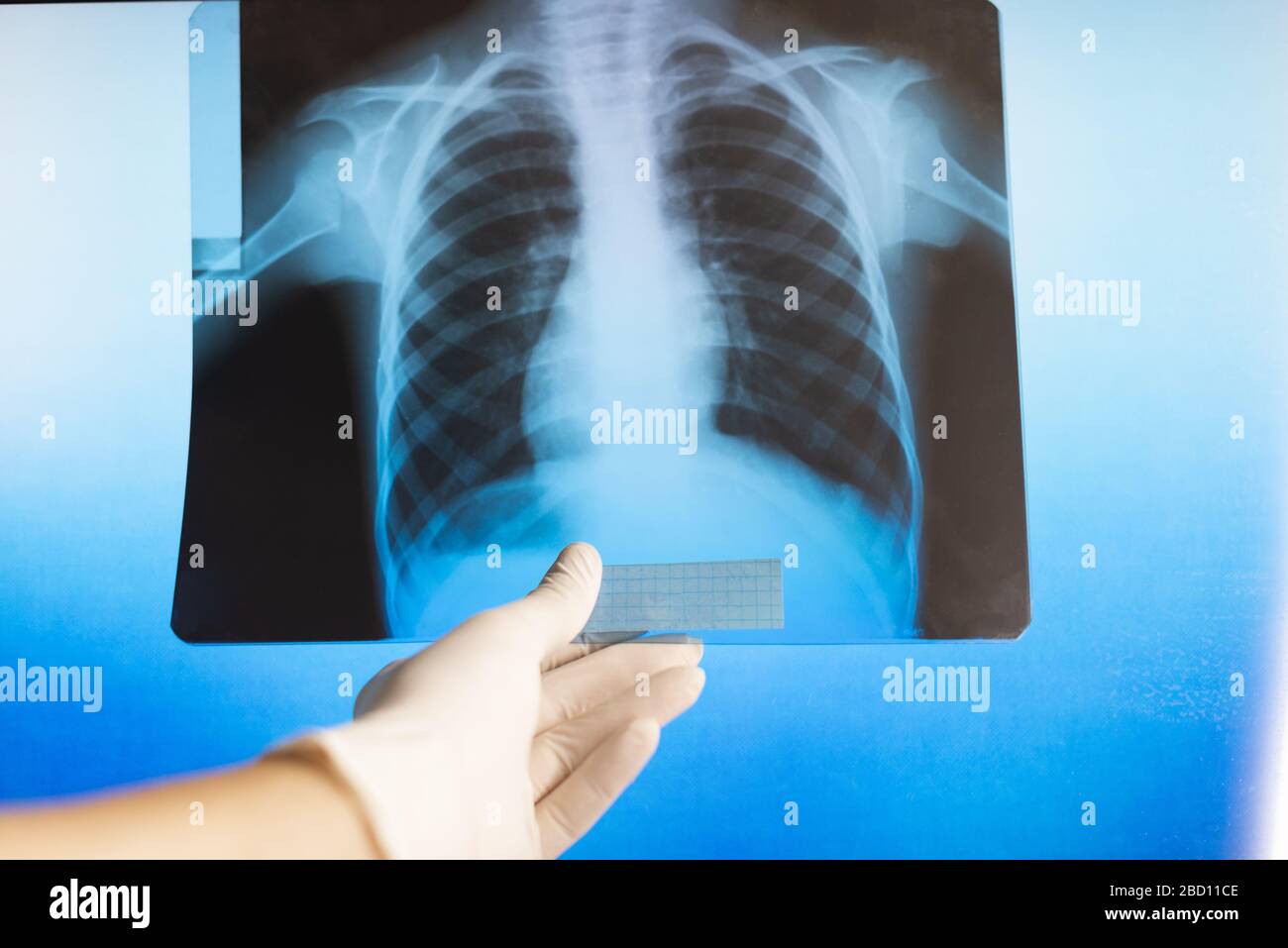 Arzt untersucht eine Röntgenaufnahme in einem Krankenhaus. Medizinische Radiographie des Thorax Stockfoto