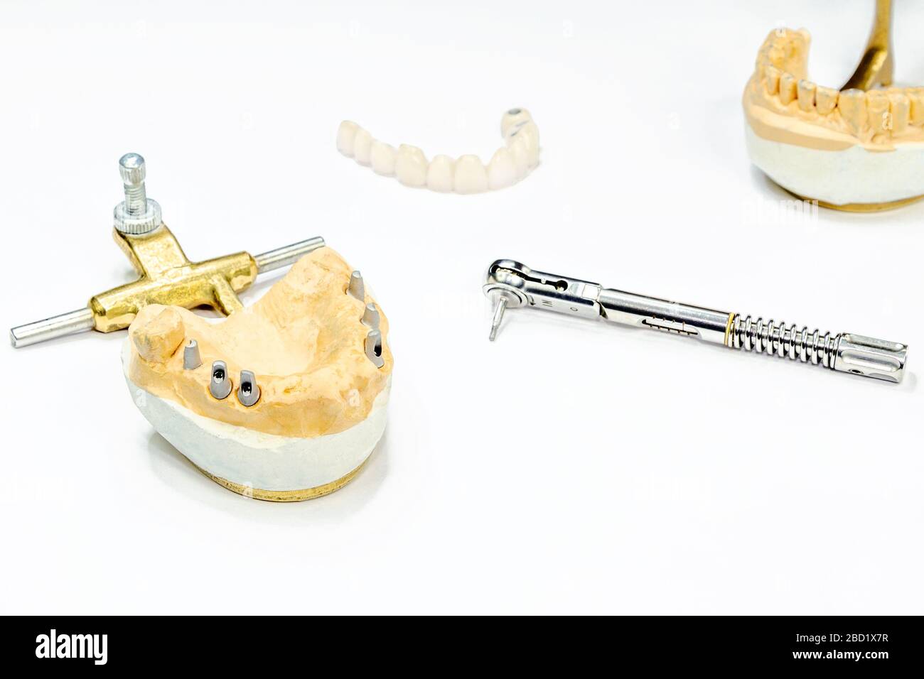 Der Prozess der Herstellung von keramischen Zähnen auf Implantaten. Zahnimplantate mit keramischen Zähnen auf einem hellen Hintergrund. Konzept der Zahnimplantation und d Stockfoto