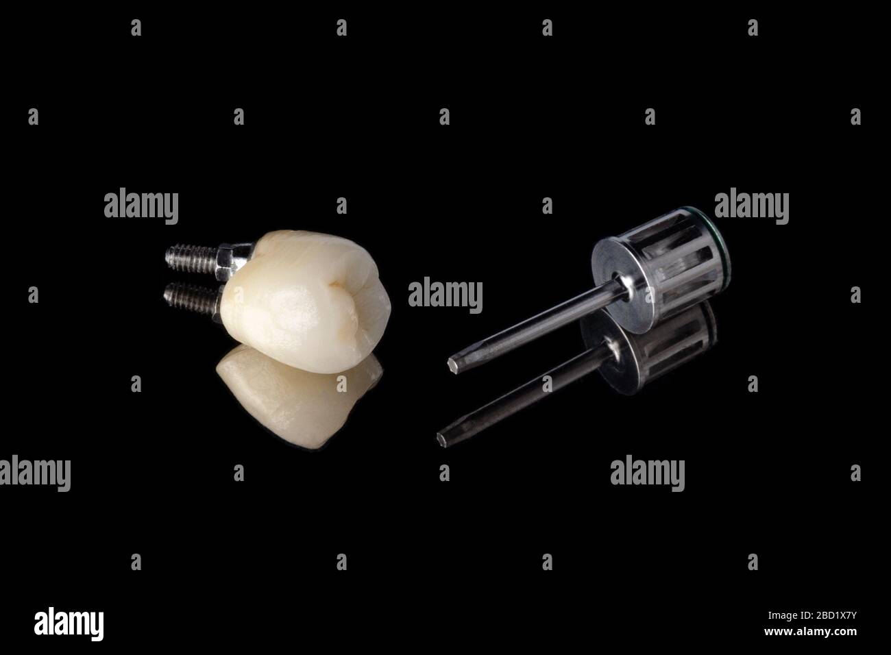 Keramikzahn auf dem Implantat mit ausgeprägter Anatomie und einem Metallschrauber zum Verdrehen der Krone zum Implantat. Isoliert auf schwarzem Hintergrund. Oder Stockfoto