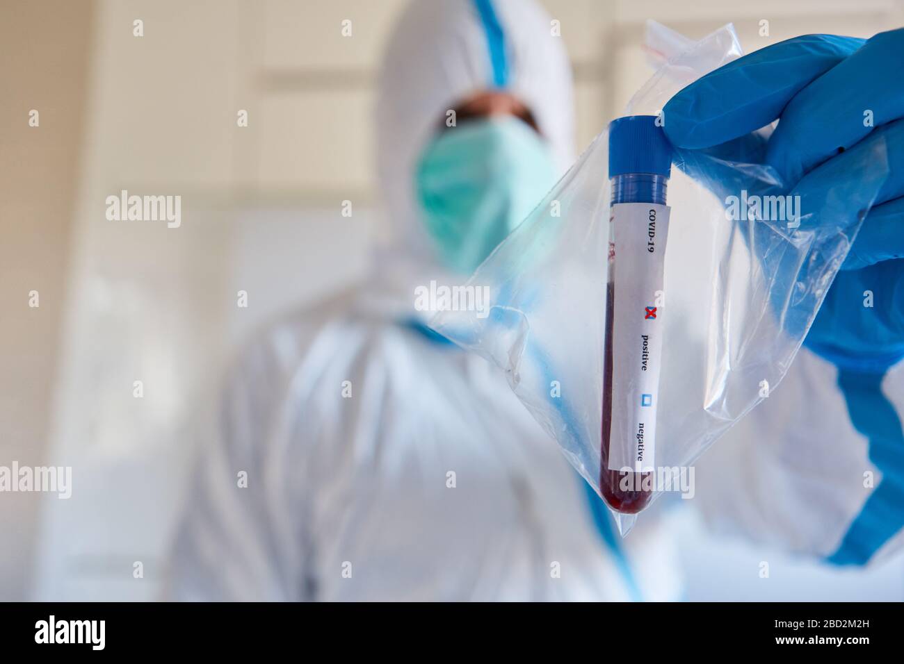 Forscher in Schutzkleidung mit Test für Covid-19-positiv mit Blutprobe und Antikörper im Labor Stockfoto