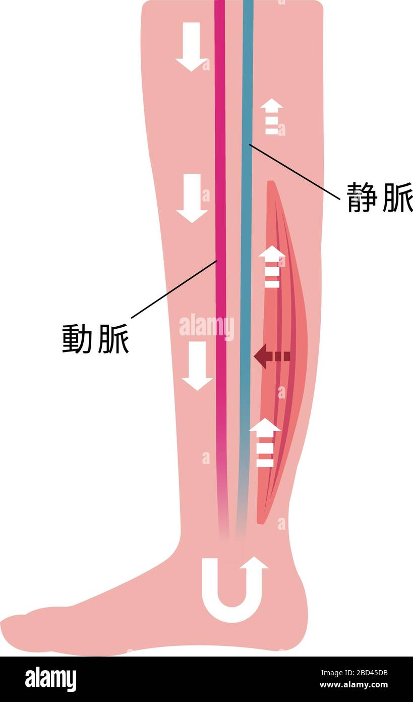 Ursache für Schwellungen (Ödem) der Beine. Verminderte Durchblutung durch Muskelschwäche. Flache Abbildung. Stock Vektor