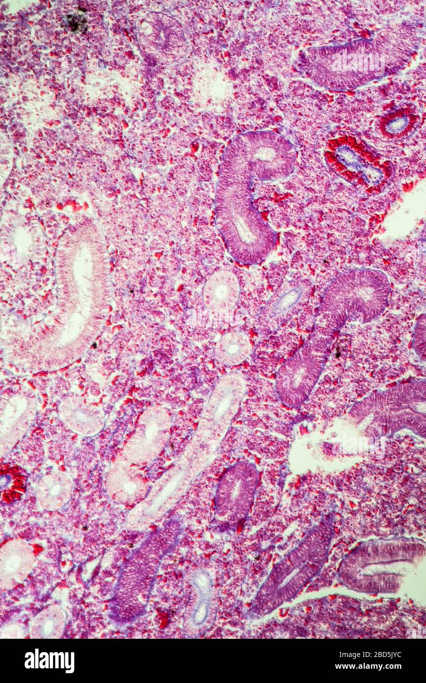 Pike Niere im Querschnitt 100x Stockfoto