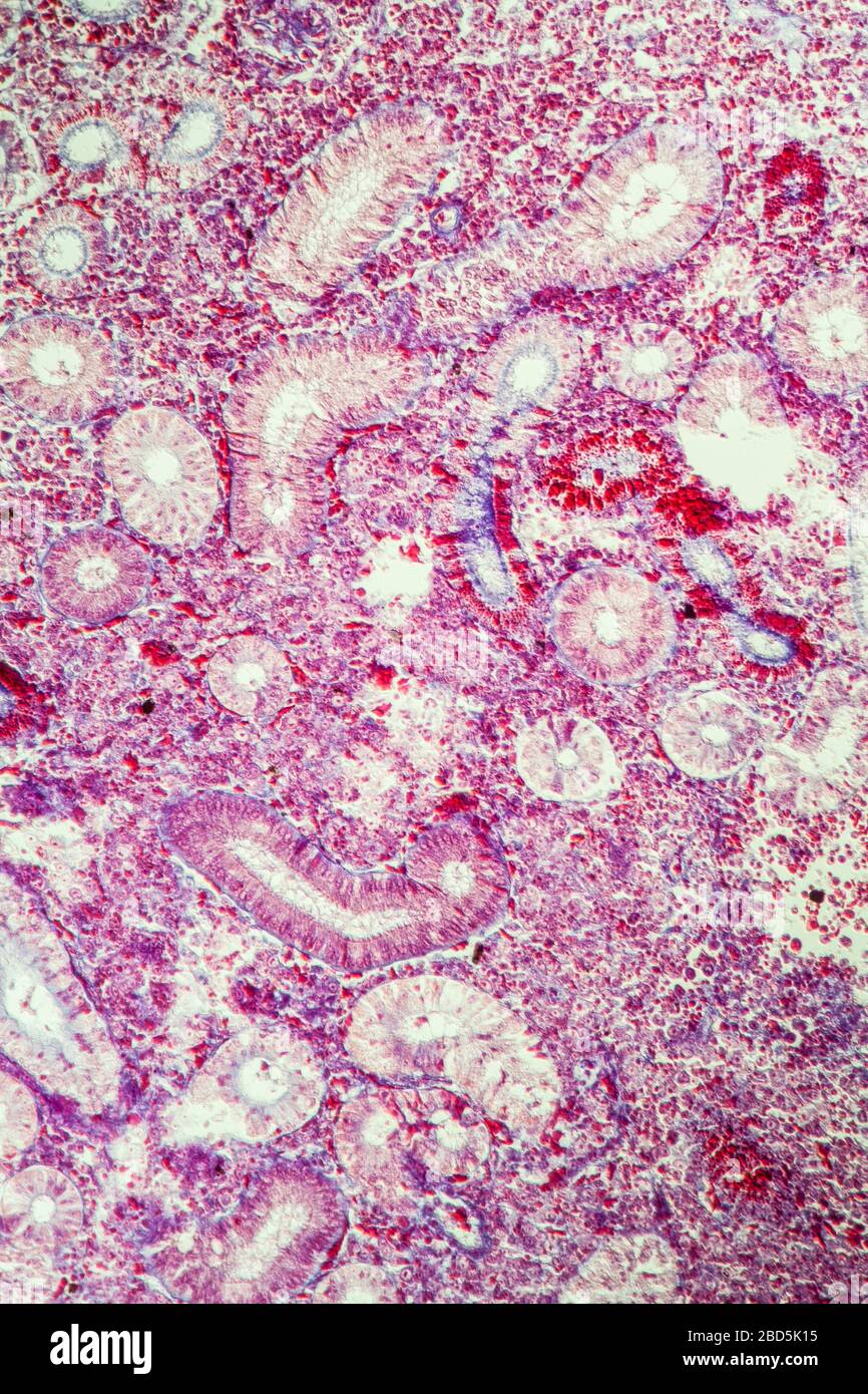 Pike Niere im Querschnitt 100x Stockfoto