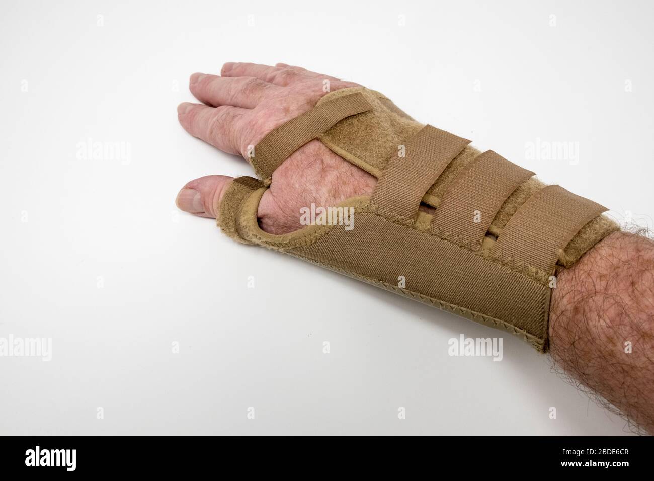 Detail des Mannes, der Handgelenkauflage für zerbrochenen Schaphoidknochen trägt. Stockfoto