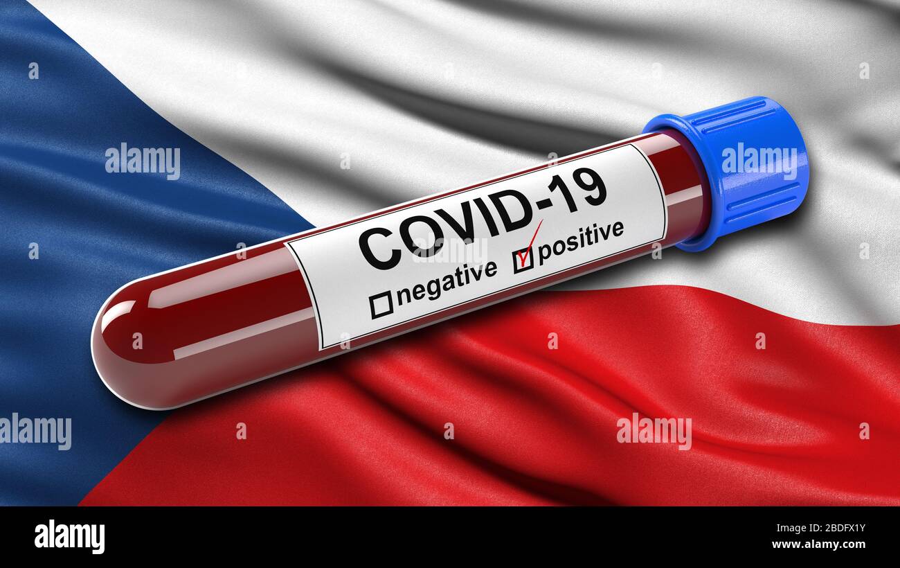 Flagge der Tschechischen Republik winkt im Wind mit einem positiven Covid-19-Bluttestschlauch. 3D-Illustrationskonzept für Blutuntersuchungen zur Diagnose des Stockfoto