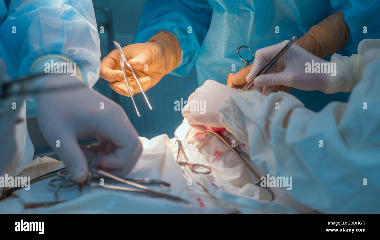 Nahaufnahme, die Hände von Kinderchirurgen und ein Assistent, der einen kleinen Patienten mit einer Hinter-Ohr-Lymphadenitis operiert. In einem sterilen Operationssaal. R Stockfoto