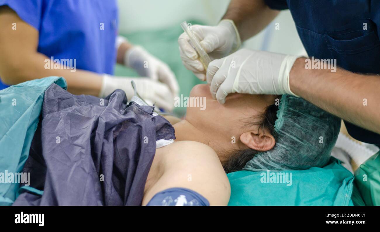 Der Arzt des Anästhesisten wendet den Endotrachealtubus auf den Patienten an. Geringe Schärfentiefe Stockfoto