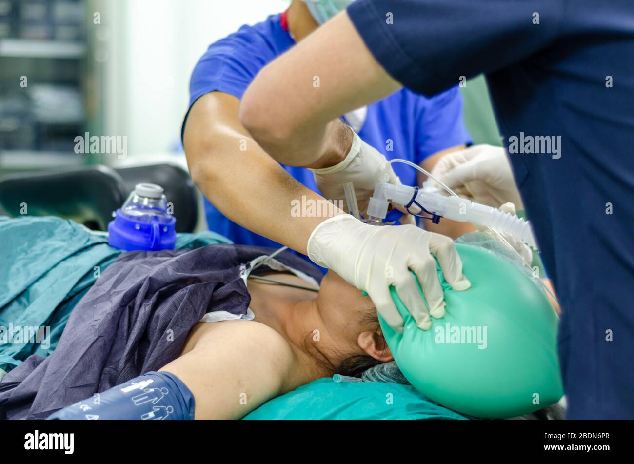 Der Arzt des Anästhesisten wendet den Endotrachealtubus auf den Patienten an. Geringe Schärfentiefe Stockfoto