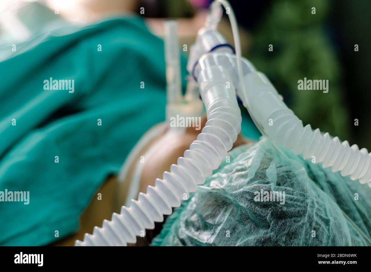 Patient mit Endotrachealtubus im Operationssaal, selektiver Fokus. Stockfoto