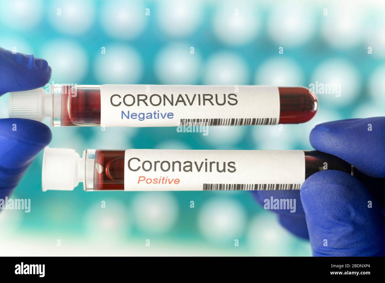 Coronavirus-Tests - ein positiver und ein negativer Halt durch einen Laborarbeiter Stockfoto