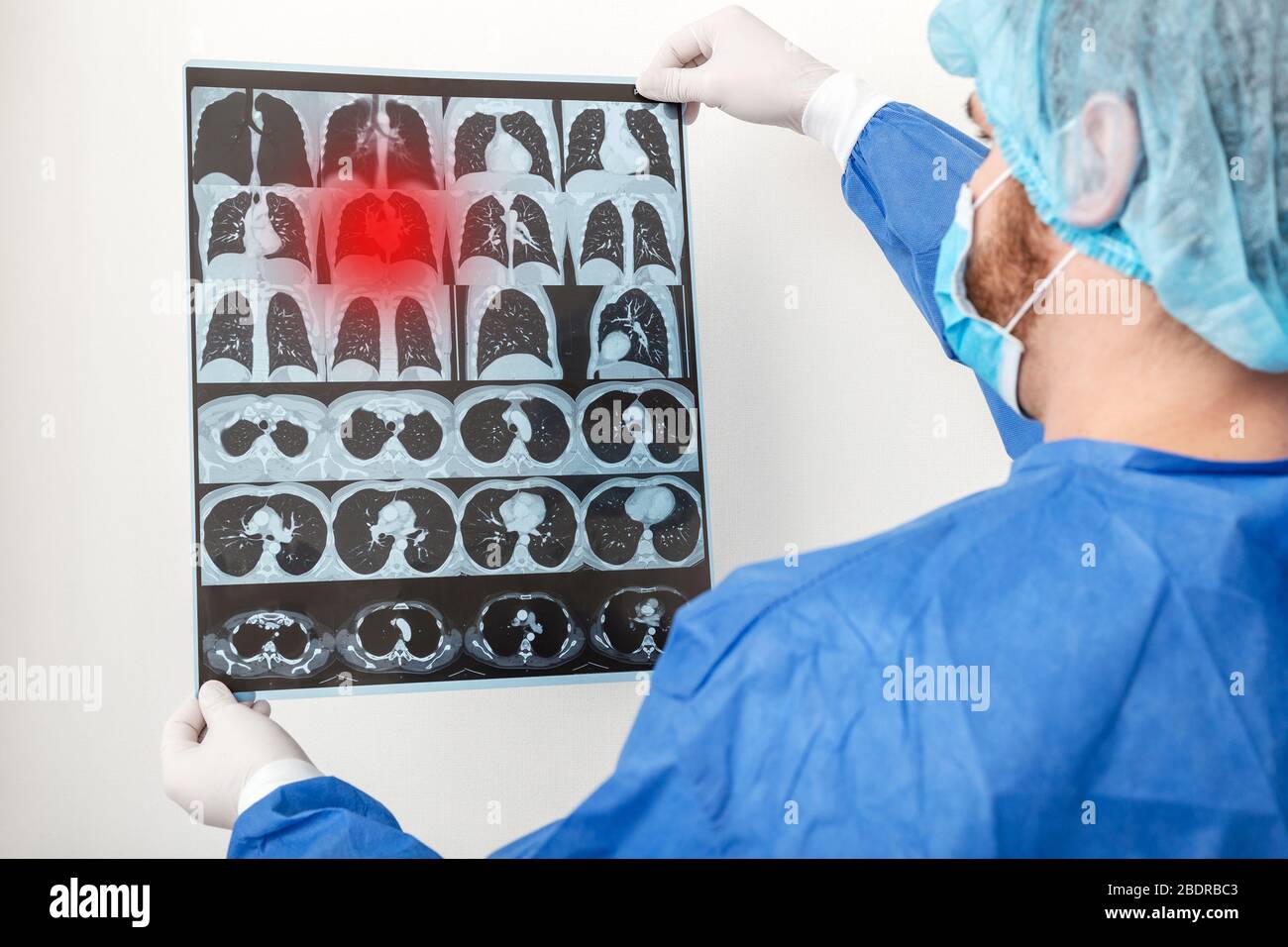 Arzt Chirurg in schützenden uniform überprüfen Röntgenfilm der Lunge Scan. Coronavirus Covid 19, Lungenentzündung, Tuberkulose, Lungenkrebs, Atemwege Stockfoto