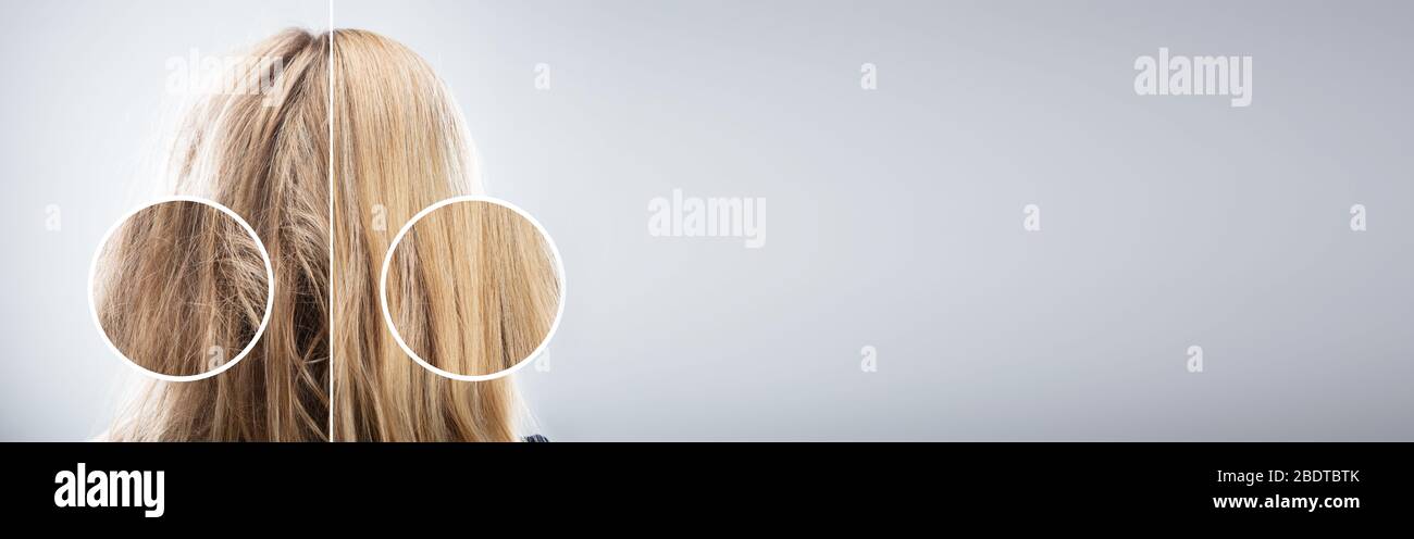 Beschädigte Haare Von Frauen Vor Und Nach Keratin Care Stockfoto