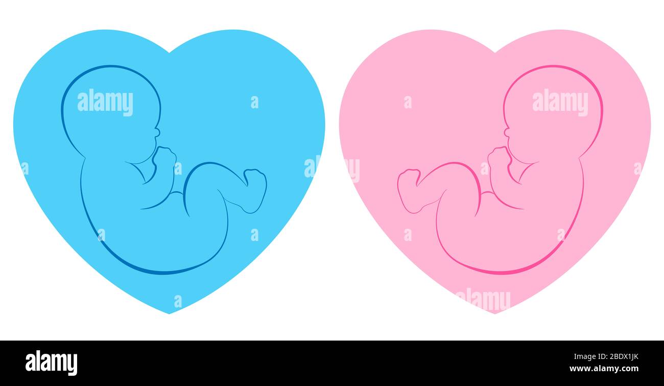 Piktogramm der Zwillinge. Baby Junge und Baby Mädchen auf blau und rosa Herz gerahmten Hintergrund. Stockfoto
