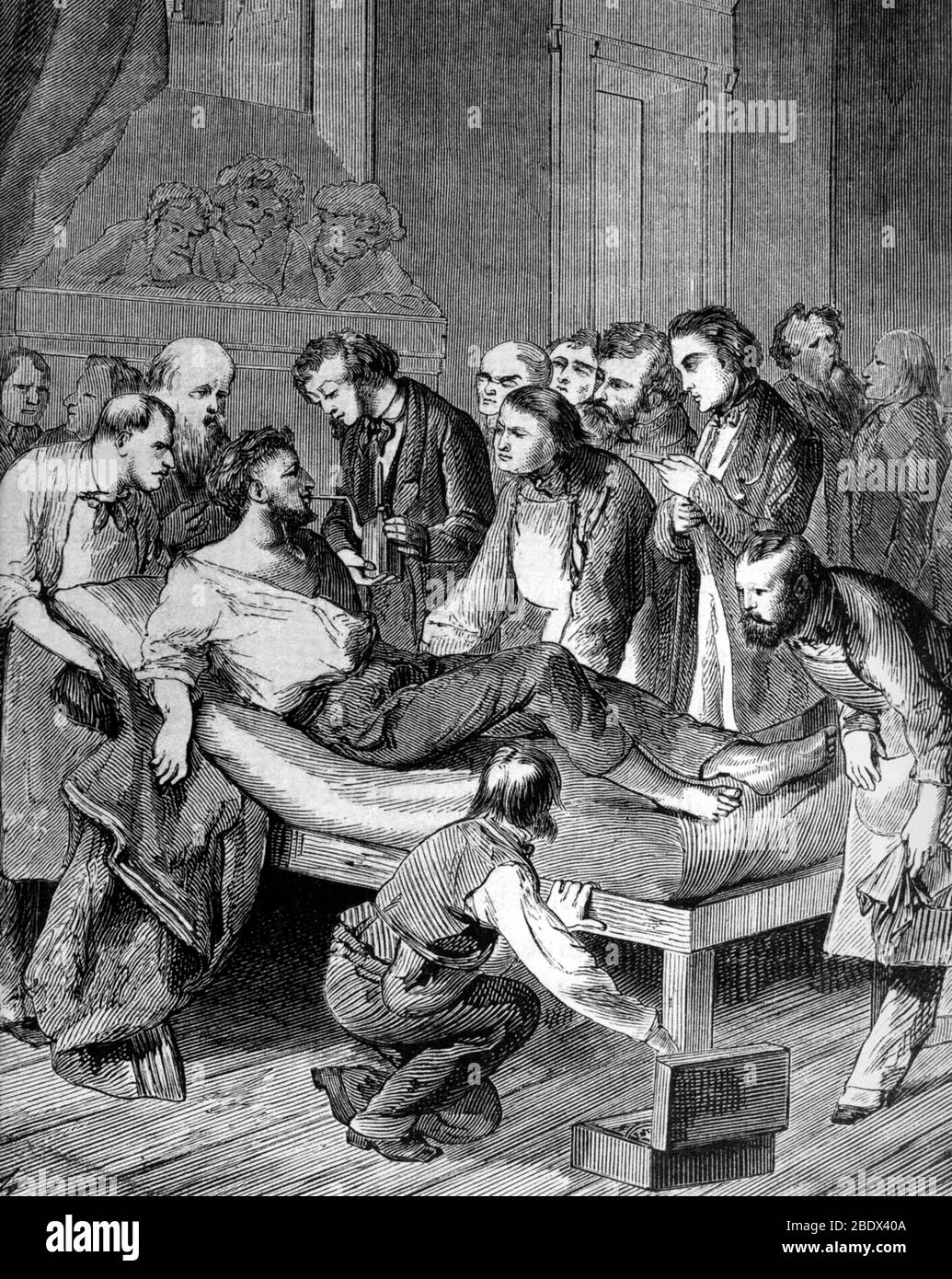 William Morton, erste Anwendung der chirurgischen Anästhesie, 1846 Stockfoto