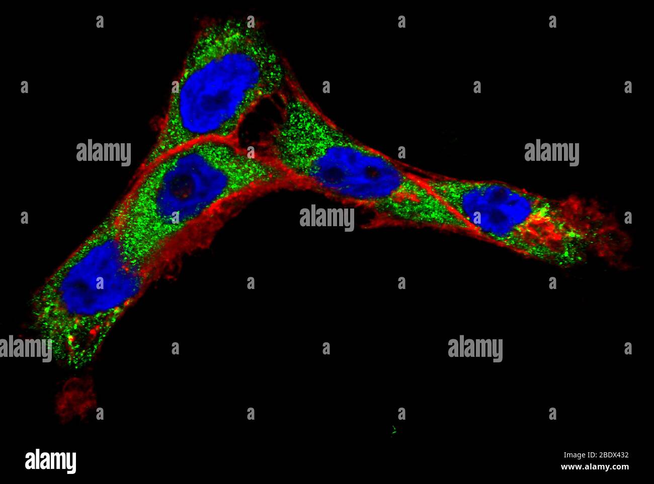 Krebs-Erkennende Nanopartikel Stockfoto